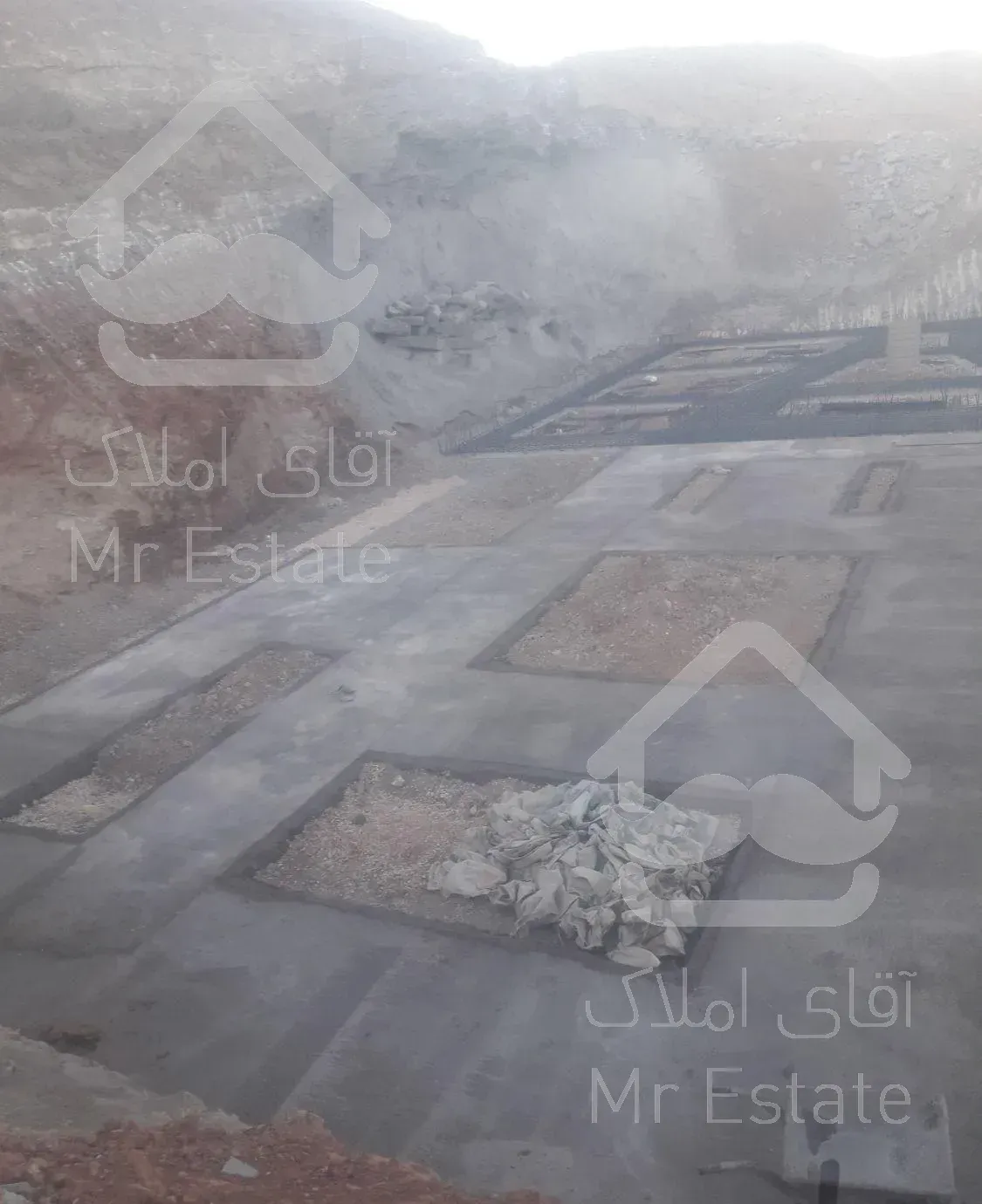 بتن مگر گودبرداری با دوربین